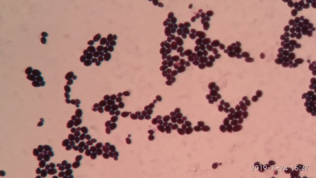 Levures de Candida albicans au microscope