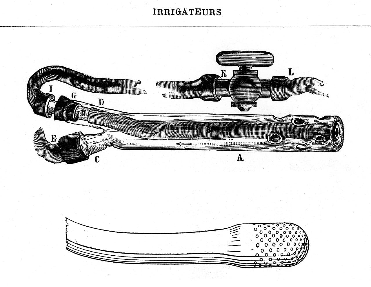Matériel d'irrigation pour lavement intestinal
