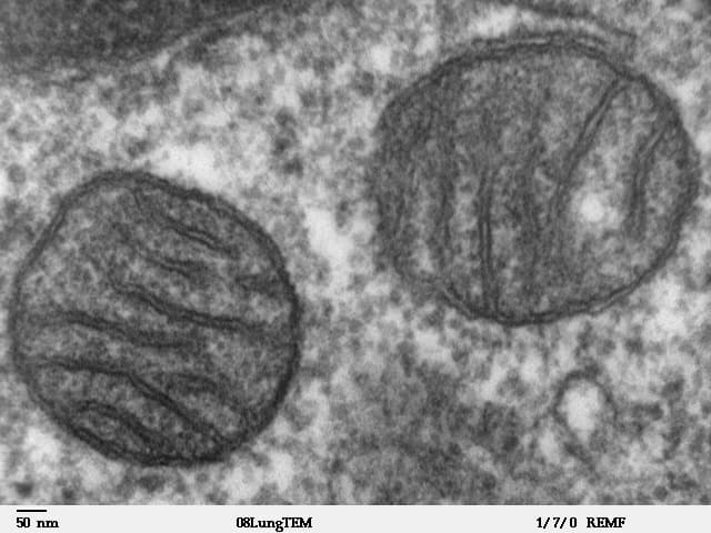 Mitochondries, énergie cellulaire (microscopie)